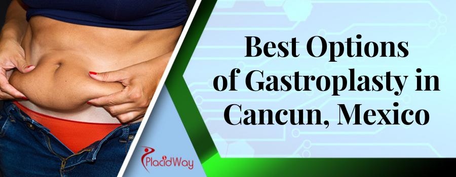 Best Options of Gastroplasty in Cancun, Mexico